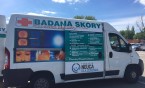 Bezpłatna diagnostyka znamion w Siemianowicach Śląskich