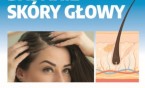 Bezpłatne badania skóry głowy i włosów