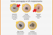 Grafika: wygląd niepokojących znamion